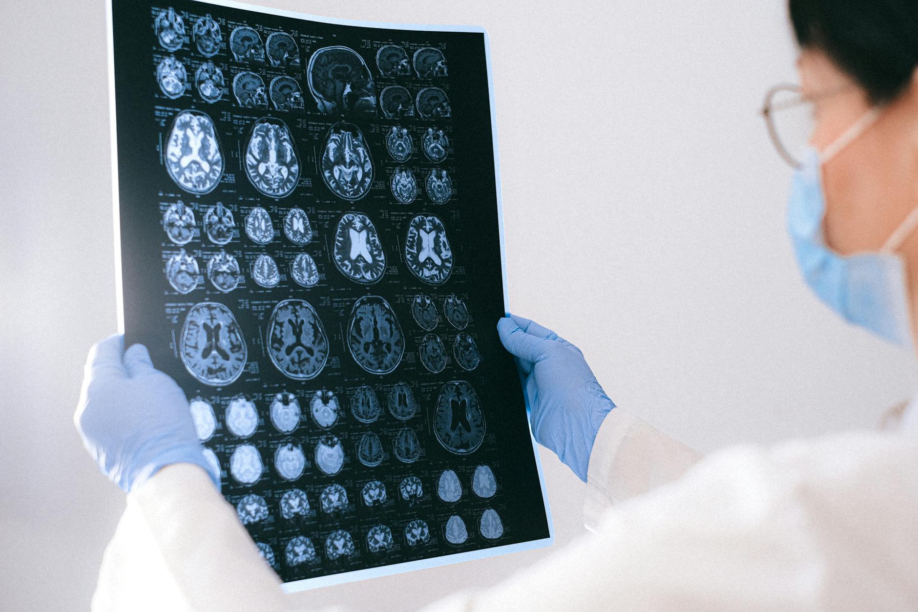 A clinician reviews brain scans during neurological research workup.