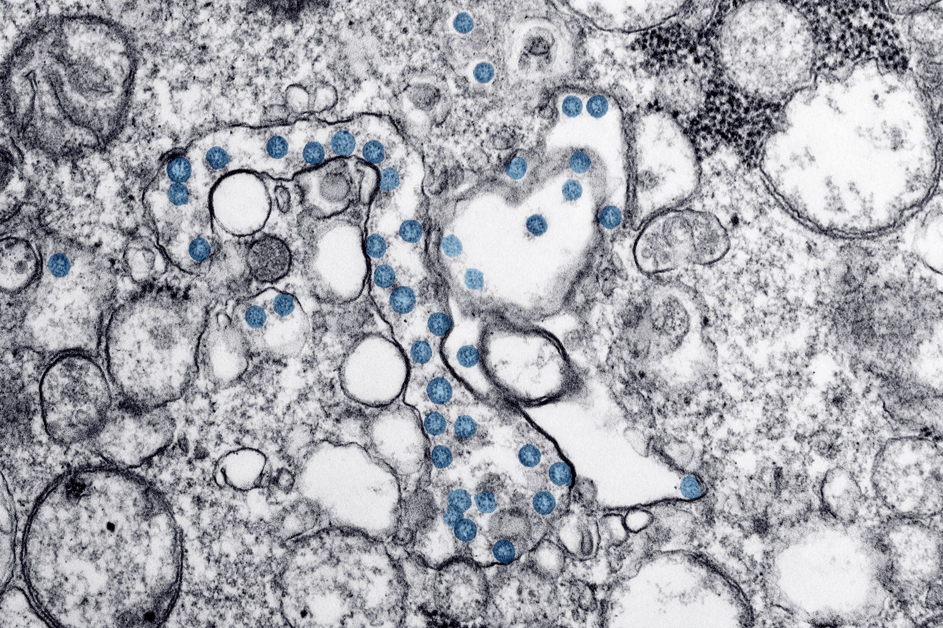 Abstract biological texture in blue and grey tones, evoking the cellular stress pathways discussed in the study.
